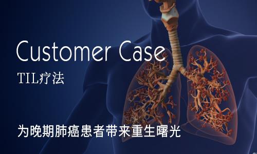 TIL疗法让晚期肺癌获得缓解