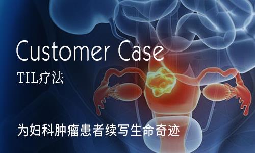 中国TIL疗法宣战妇科肿瘤