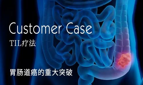 TIL疗法直肠癌的“逆袭”